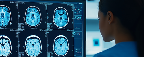 A medical professional analyzes MRI scans on a monitor, focusing on brain images for diagnostics and patient care.